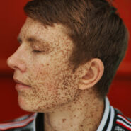 Парень с веснушками